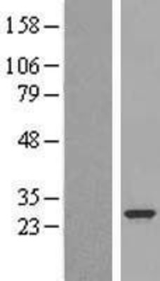 Western Blot: PLUNC Overexpression Lysate (Adult Normal) [NBL1-14531] Left-Empty vector transfected control cell lysate (HEK293 cell lysate); Right -Over-expression Lysate for PLUNC.