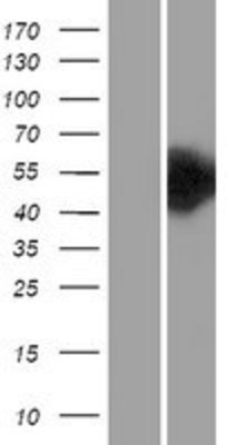 Western Blot: Choline kinase alpha Overexpression Lysate (Adult Normal) [NBL1-09157] Left-Empty vector transfected control cell lysate (HEK293 cell lysate); Right -Over-expression Lysate for Choline kinase alpha.