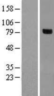 Western Blot: RHOBTB1 Overexpression Lysate (Adult Normal) [NBL1-15351] Left-Empty vector transfected control cell lysate (HEK293 cell lysate); Right -Over-expression Lysate for RHOBTB1.