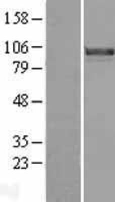 Western Blot: FOXM1 Overexpression Lysate (Adult Normal) [NBL1-10809] Left-Empty vector transfected control cell lysate (HEK293 cell lysate); Right -Over-expression Lysate for FOXM1.