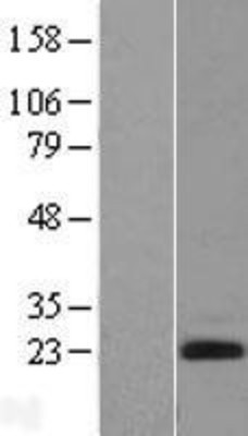Western Blot: Endothelin 2 Overexpression Lysate (Adult Normal) [NBL1-10114] Left-Empty vector transfected control cell lysate (HEK293 cell lysate); Right -Over-expression Lysate for Endothelin 2.