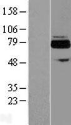 Western Blot: FLJ21963 Overexpression Lysate (Adult Normal) [NBL1-07271] Left-Empty vector transfected control cell lysate (HEK293 cell lysate); Right -Over-expression Lysate for FLJ21963.