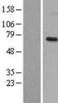 Western Blot: Dyrk1B Overexpression Lysate (Adult Normal) [NBL1-10075] Left-Empty vector transfected control cell lysate (HEK293 cell lysate); Right -Over-expression Lysate for Dyrk1B.
