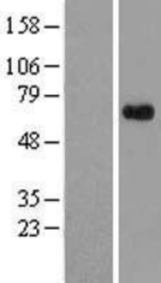 Western Blot: APLF Overexpression Lysate (Adult Normal) [NBL1-08402] Left-Empty vector transfected control cell lysate (HEK293 cell lysate); Right -Over-expression Lysate for APLF.