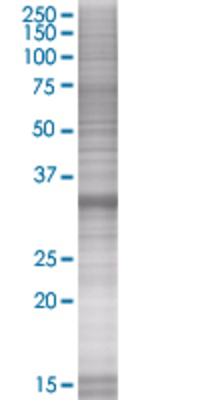 MYD88 transfected lysate.