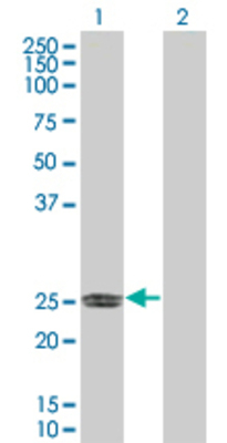 Lane 1: ERAS transfected lysate (25.3 KDa) Lane 2: Non-transfected lysate.