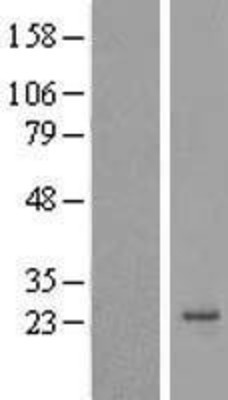 Western Blot: Apc11 Overexpression Lysate (Adult Normal) [NBL1-07513] Left-Empty vector transfected control cell lysate (HEK293 cell lysate); Right -Over-expression Lysate for Apc11.