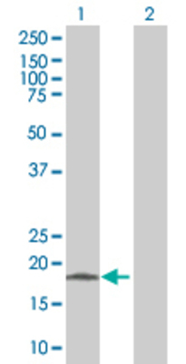 Lane 1: CD8A transfected lysate (25.7 KDa). Lane 2: Non-transfected lysate.