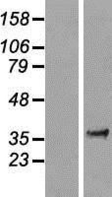 Western Blot: FAM84A Overexpression Lysate (Adult Normal) [NBL1-10576] Left-Empty vector transfected control cell lysate (HEK293 cell lysate); Right -Over-expression Lysate for FAM84A.