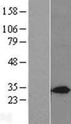Western Blot: Syntaxin 7 Overexpression Lysate (Adult Normal) [NBL1-16585] Left-Empty vector transfected control cell lysate (HEK293 cell lysate); Right -Over-expression Lysate for Syntaxin 7.