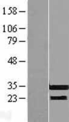 Western Blot: RFPL3 Overexpression Lysate (Adult Normal) [NBL1-15301] Left-Empty vector transfected control cell lysate (HEK293 cell lysate); Right -Over-expression Lysate for RFPL3.