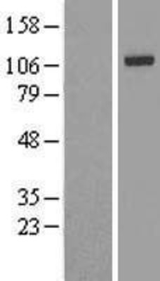 Western Blot: IRP2 Overexpression Lysate (Adult Normal) [NBL1-12029] Left-Empty vector transfected control cell lysate (HEK293 cell lysate); Right -Over-expression Lysate for IRP2.