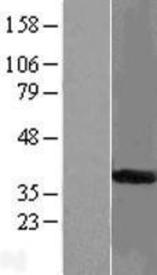 Western Blot: START domain containing 7 Overexpression Lysate (Adult Normal) [NBL1-16522] Left-Empty vector transfected control cell lysate (HEK293 cell lysate); Right -Over-expression Lysate for START domain containing 7.