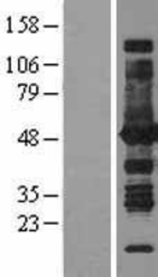 Western Blot: Argininosuccinate Synthase Overexpression Lysate (Adult Normal) [NBL1-07778] Left-Empty vector transfected control cell lysate (HEK293 cell lysate); Right -Over-expression Lysate for Argininosuccinate Synthase.