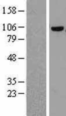 Western Blot: COPG Overexpression Lysate (Adult Normal) [NBL1-09379] Left-Empty vector transfected control cell lysate (HEK293 cell lysate); Right -Over-expression Lysate for COPG.