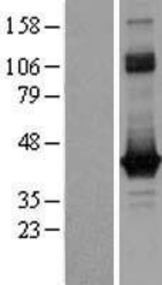 Western Blot: GO Protein alpha Overexpression Lysate (Adult Normal) [NBL1-11158] Left-Empty vector transfected control cell lysate (HEK293 cell lysate); Right -Over-expression Lysate for GO Protein alpha.