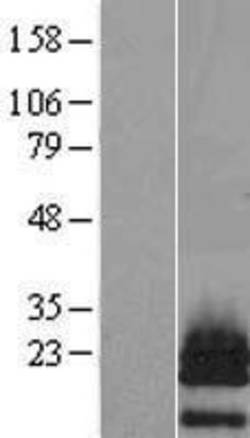 Western Blot: PTHLH Overexpression Lysate (Adult Normal) [NBL1-14949] Left-Empty vector transfected control cell lysate (HEK293 cell lysate); Right -Over-expression Lysate for PTHLH.