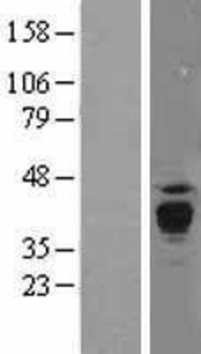 Western Blot: PPT1 Overexpression Lysate (Adult Normal) [NBL1-14713] Left-Empty vector transfected control cell lysate (HEK293 cell lysate); Right -Over-expression Lysate for PPT1.