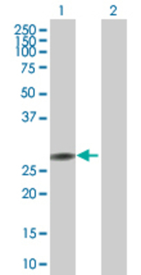 Lane 1: PPP2R3B transfected lysate (19.47 KDa) Lane 2: Non-transfected lysate.