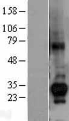 Western Blot: CTDSP1 Overexpression Lysate (Adult Normal) [NBL1-09566] Left-Empty vector transfected control cell lysate (HEK293 cell lysate); Right -Over-expression Lysate for CTDSP1.