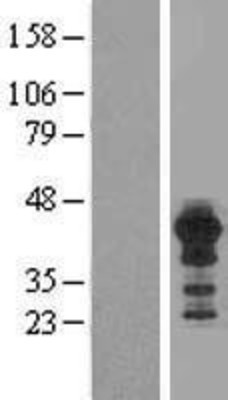 Western Blot: HOMER3 Overexpression Lysate (Adult Normal) [NBL1-11657] Left-Empty vector transfected control cell lysate (HEK293 cell lysate); Right -Over-expression Lysate for HOMER3.