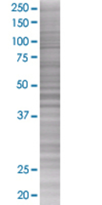 PPP2R3B transfected lysate.