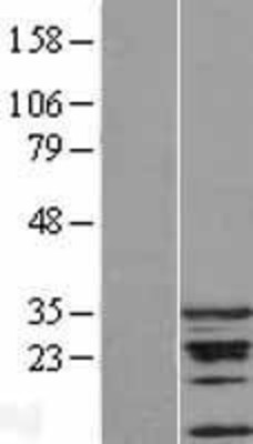 Western Blot: CDCA5 Overexpression Lysate (Adult Normal) [NBL1-09019] Left-Empty vector transfected control cell lysate (HEK293 cell lysate); Right -Over-expression Lysate for CDCA5.