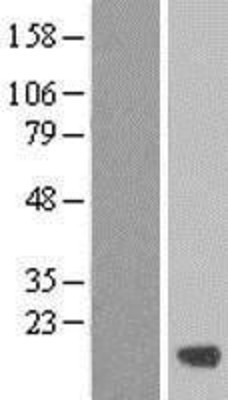 Western Blot: C19orf24 Overexpression Lysate (Adult Normal) [NBL1-08265] Left-Empty vector transfected control cell lysate (HEK293 cell lysate); Right -Over-expression Lysate for C19orf24.