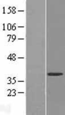 Western Blot: FUR1 Overexpression Lysate (Adult Normal) [NBL1-17627] Left-Empty vector transfected control cell lysate (HEK293 cell lysate); Right -Over-expression Lysate for FUR1.
