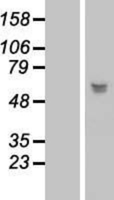 Western Blot: LRRC17 Overexpression Lysate (Adult Normal) [NBL1-12677] Left-Empty vector transfected control cell lysate (HEK293 cell lysate); Right -Over-expression Lysate for LRRC17.