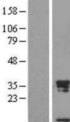 Western Blot: Uteroglobin Overexpression Lysate (Adult Normal) [NBL1-15732] Left-Empty vector transfected control cell lysate (HEK293 cell lysate); Right -Over-expression Lysate for Uteroglobin.