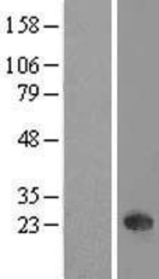 Western Blot: NKIRAS1 Overexpression Lysate (Adult Normal) [NBL1-13655] Left-Empty vector transfected control cell lysate (HEK293 cell lysate); Right -Over-expression Lysate for NKIRAS1.