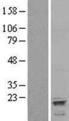 Western Blot: AVPI1 Overexpression Lysate (Adult Normal) [NBL1-07864] Left-Empty vector transfected control cell lysate (HEK293 cell lysate); Right -Over-expression Lysate for AVPI1.