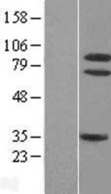 Western Blot: TrkA Overexpression Lysate (Adult Normal) [NBL1-13835] Left-Empty vector transfected control cell lysate (HEK293 cell lysate); Right -Over-expression Lysate for TrkA.