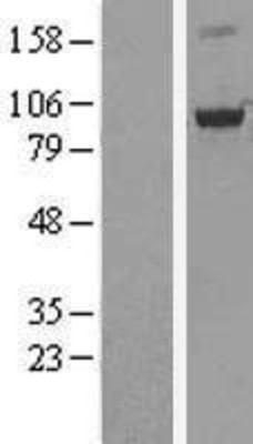Western Blot: OSBP1 Overexpression Lysate (Adult Normal) [NBL1-13984] Left-Empty vector transfected control cell lysate (HEK293 cell lysate); Right -Over-expression Lysate for OSBP1.