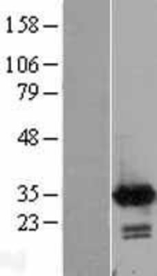Western Blot: Calretinin Overexpression Lysate (Adult Normal) [NBL1-08641] Left-Empty vector transfected control cell lysate (HEK293 cell lysate); Right -Over-expression Lysate for Calretinin.