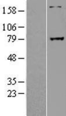 Western Blot: GREB1 Overexpression Lysate (Adult Normal) [NBL1-11329] Left-Empty vector transfected control cell lysate (HEK293 cell lysate); Right -Over-expression Lysate for GREB1.