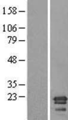 Western Blot: C6orf64 Overexpression Lysate (Adult Normal) [NBL1-08536] Left-Empty vector transfected control cell lysate (HEK293 cell lysate); Right -Over-expression Lysate for C6orf64.