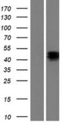 Western Blot: Nptx1 Overexpression Lysate (Adult Normal) [NBP2-08105] Left-Empty vector transfected control cell lysate (HEK293 cell lysate); Right -Over-expression Lysate for Nptx1.