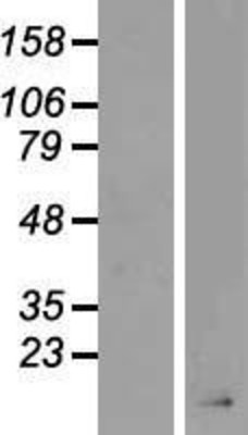 Western Blot: AGRP Overexpression Lysate (Adult Normal) [NBP2-08229] Left-Empty vector transfected control cell lysate (HEK293 cell lysate); Right -Over-expression Lysate for AGRP.