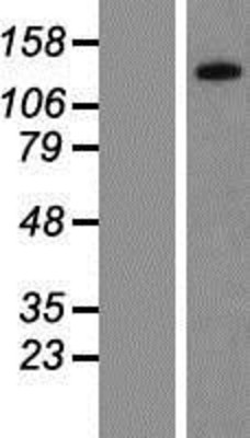 Western Blot: PPP1R3A Overexpression Lysate (Adult Normal) [NBP2-08079] Left-Empty vector transfected control cell lysate (HEK293 cell lysate); Right -Over-expression Lysate for PPP1R3A.