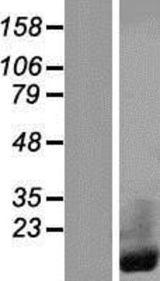 Western Blot: CRIP1 Overexpression Lysate (Adult Normal) [NBP2-08218] Left-Empty vector transfected control cell lysate (HEK293 cell lysate); Right -Over-expression Lysate for CRIP1.