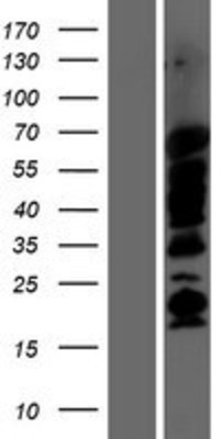 Western Blot: SHB Overexpression Lysate (Adult Normal) [NBP2-08047] Left-Empty vector transfected control cell lysate (HEK293 cell lysate); Right -Over-expression Lysate for SHB.