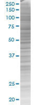 TRAF7 transfected lysate.