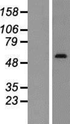 Western Blot: SNX1 Overexpression Lysate (Adult Normal) [NBP2-08038] Left-Empty vector transfected control cell lysate (HEK293 cell lysate); Right -Over-expression Lysate for SNX1.
