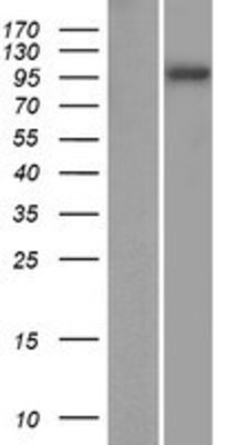 Western Blot: SPAG1 Overexpression Lysate (Adult Normal) [NBP2-08036] Left-Empty vector transfected control cell lysate (HEK293 cell lysate); Right -Over-expression Lysate for SPAG1.