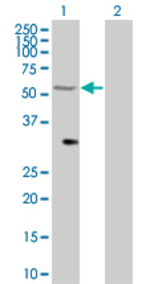 Lane 1: TRAF7 transfected lysate (65.45 KDa) Lane 2: Non-transfected lysate.