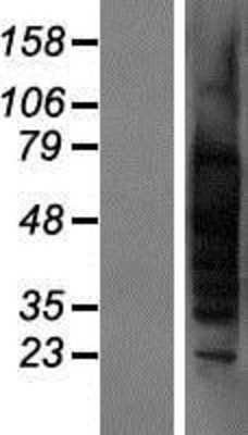 Western Blot: TSPY1 Overexpression Lysate (Adult Normal) [NBP2-08020] Left-Empty vector transfected control cell lysate (HEK293 cell lysate); Right -Over-expression Lysate for TSPY1.