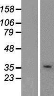 Western Blot: USF2 Overexpression Lysate (Adult Normal) [NBP2-08017] Left-Empty vector transfected control cell lysate (HEK293 cell lysate); Right -Over-expression Lysate for USF2.