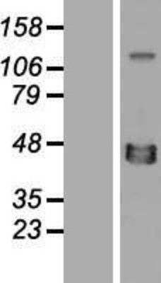 Western Blot: XRCC4 Overexpression Lysate (Adult Normal) [NBP2-08016] Left-Empty vector transfected control cell lysate (HEK293 cell lysate); Right -Over-expression Lysate for XRCC4.